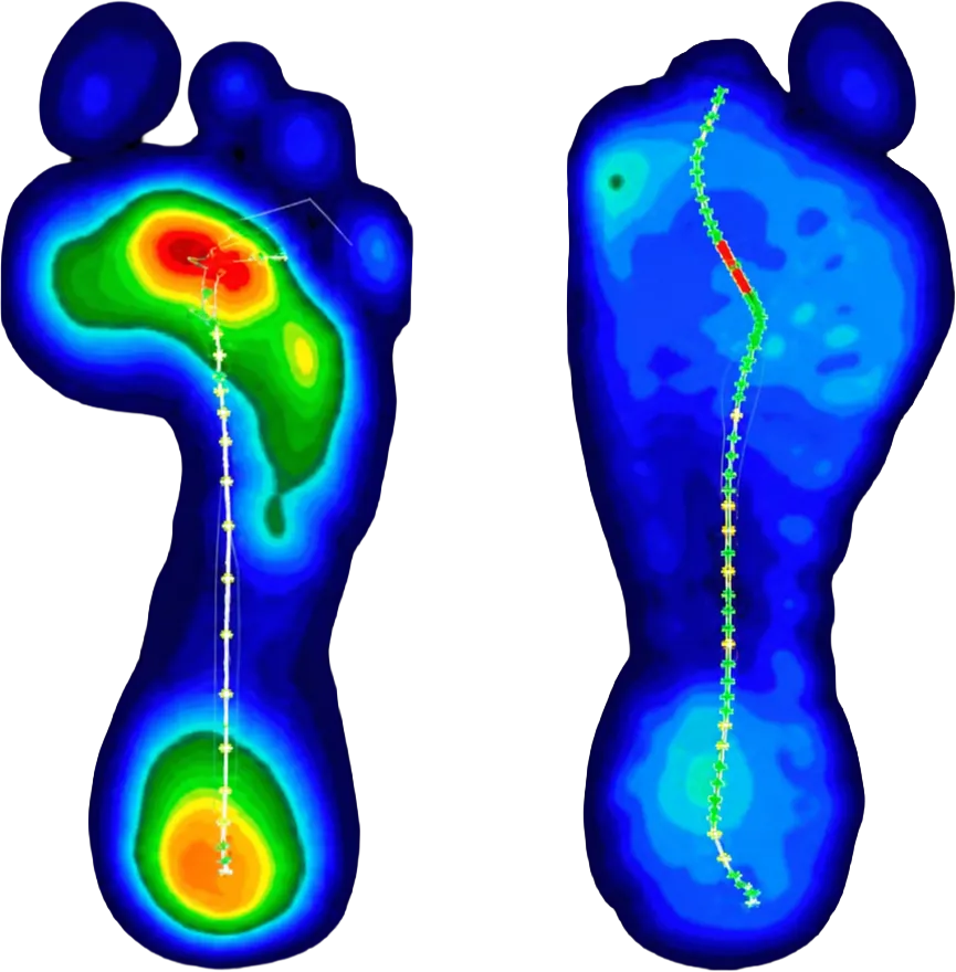 Foot pressure heatmap scan
